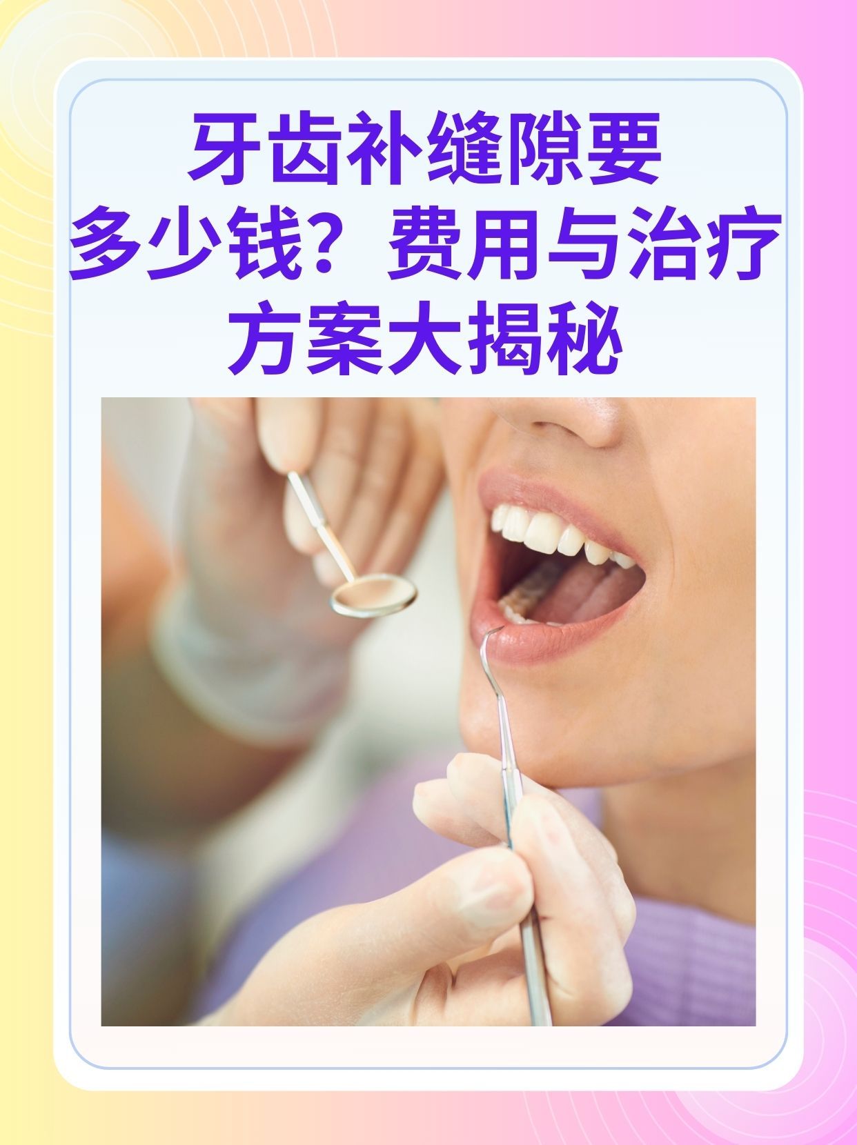 北京补牙医保可以报销吗(补牙医保可以报销吗 哪些可以报销呢)